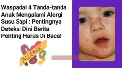 Waspadai 4 Tanda-tanda Anak Mengalami Alergi Susu Sapi : Pentingnya Deteksi Dini Berita Penting Harus Di Baca!